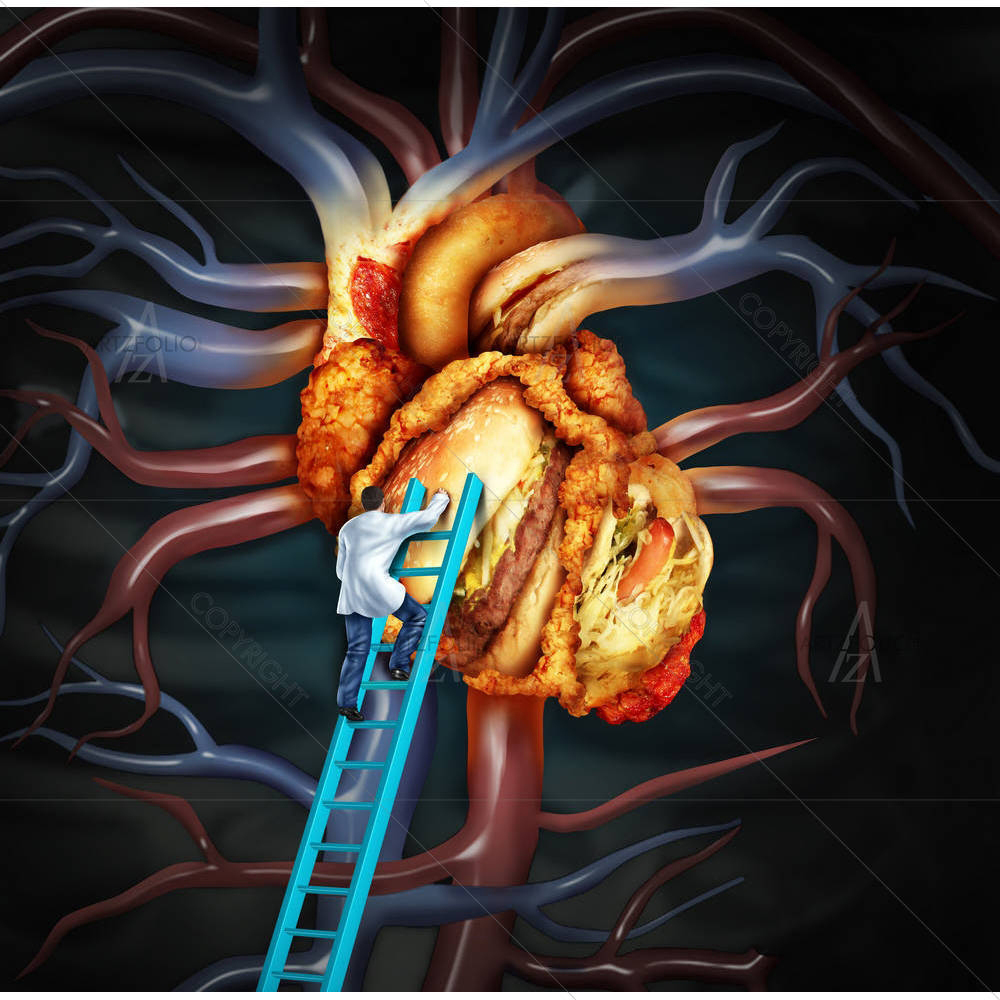 High Cholesterol Treatment — custom-size art design 5005189